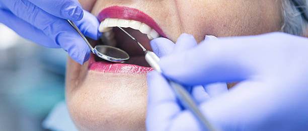 Emergency Treatment for Knocked-Out Teeth